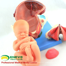 ANATOMY32 (12470) Modelo de Anatomia de Procedimento de Entrega de Parto Humano Consiste em Útero, Feto, Placenta 12470